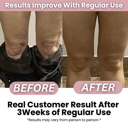 Anti-cellulite Massage Oil